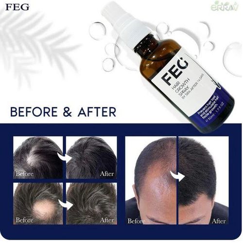 FEG Plus Hair Grow Spray