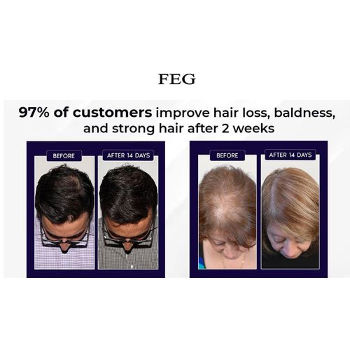 FEG Plus Hair Grow Spray