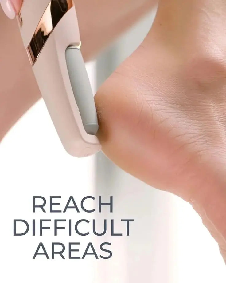 Electric Foot Callus Remover