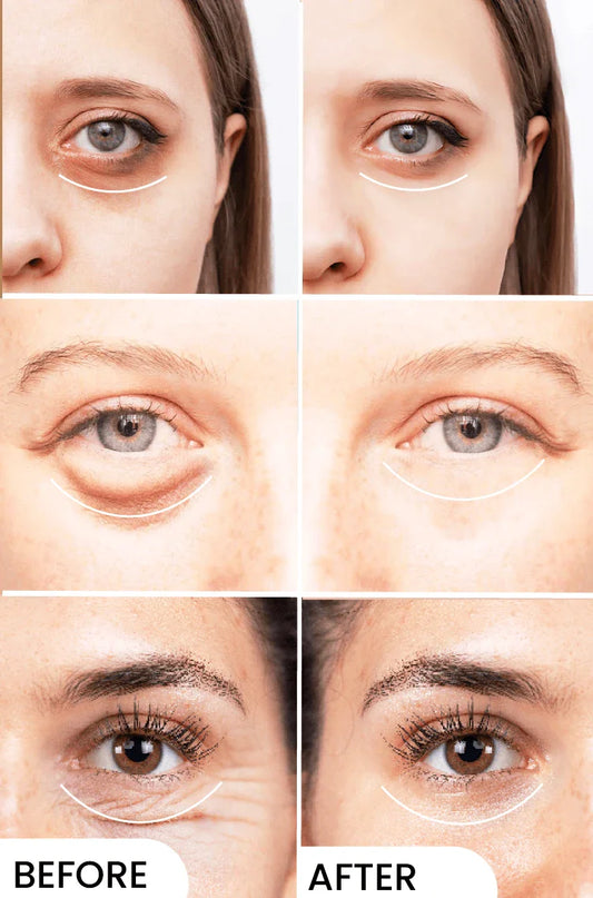 Eyelight Eye Serum - Eliminates Dark Circles & Puffy Eyes