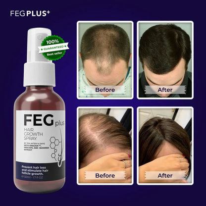 FEG Plus Hair Grow Spray