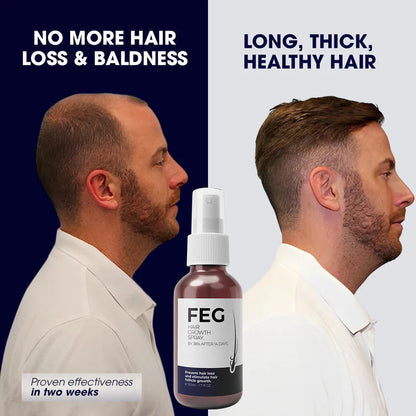 FEG Plus Hair Grow Spray