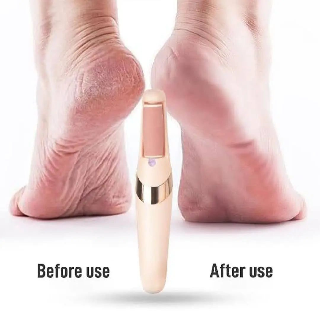 Electric Foot Callus Remover